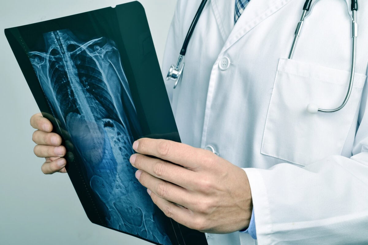 Doctor observing a skeleton radiograph